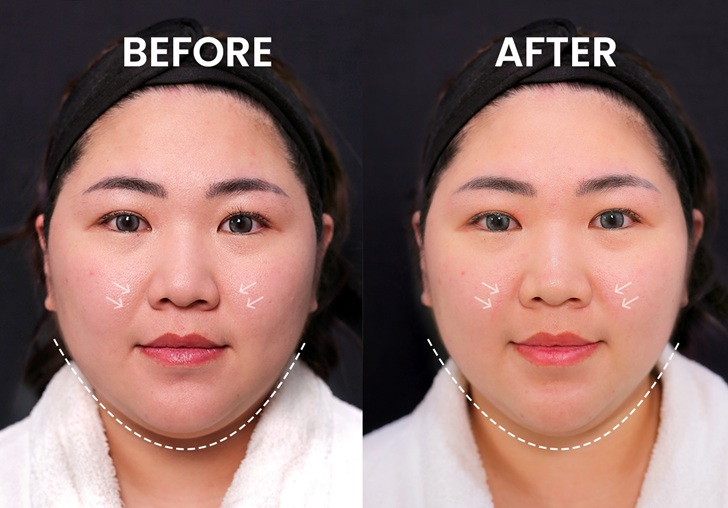 Carla Skin Clinic Hari Bumi 2025 Kampanyekan “Rejuvenate Your Skin, Rejuvenate Your Earth.” 2 Carla Skin Clinic